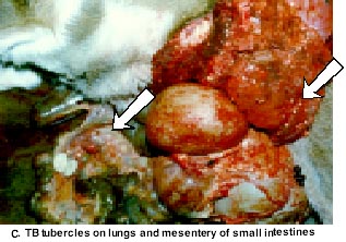 White-tailed Deer TB