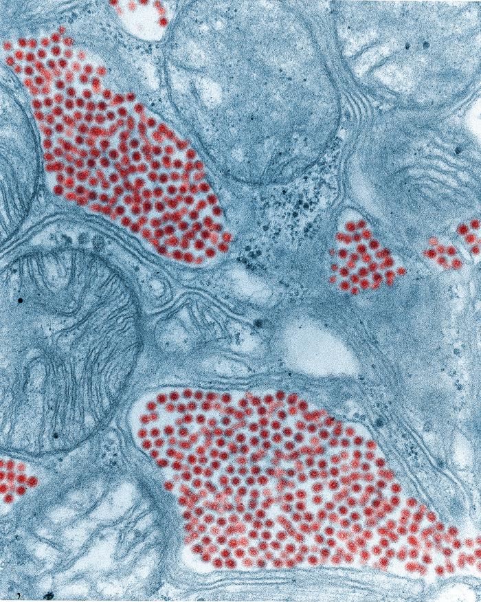 Eastern equine encephalitis virus. Centers for Disease Control and Prevention.