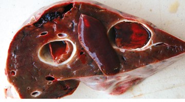 A cross section of a deer liver exposing a deer liver flukes.