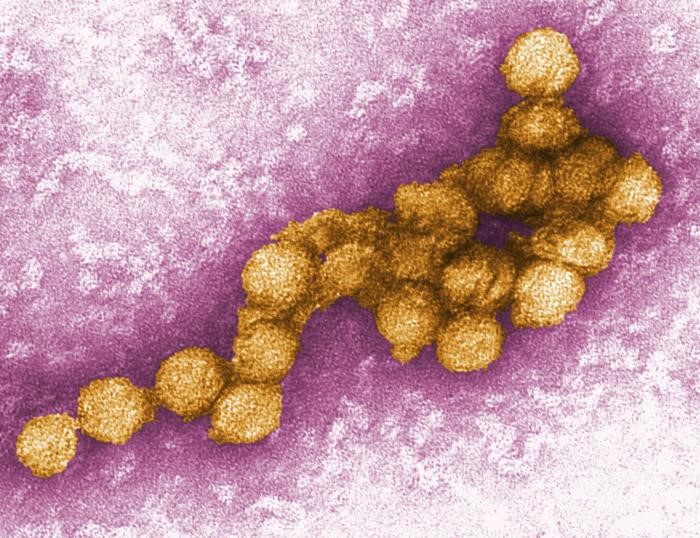 West Nile virus. Photo: P.E. Rollin, Centers for Disease Control and Prevention.