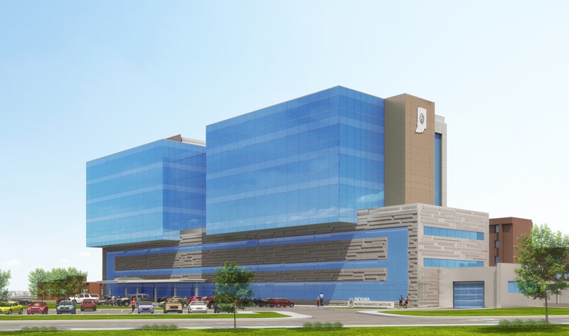 Artist Rendering 1