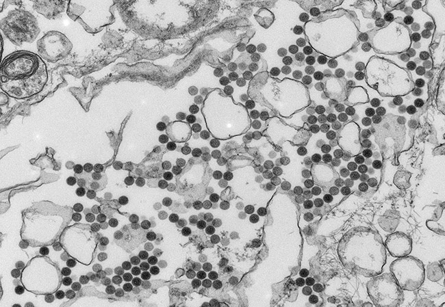 Heartland virus. Photo: Centers for Disease Control and Prevention.