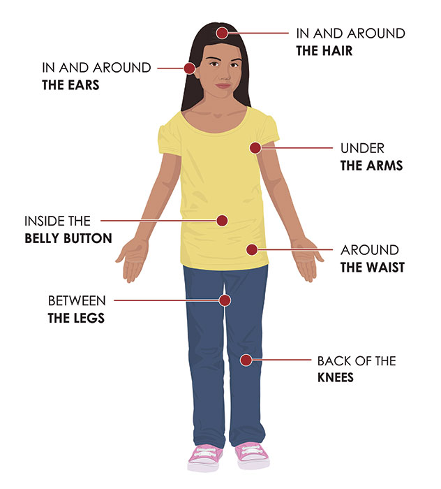 Graphic: Centers for Disease Control and Prevention.