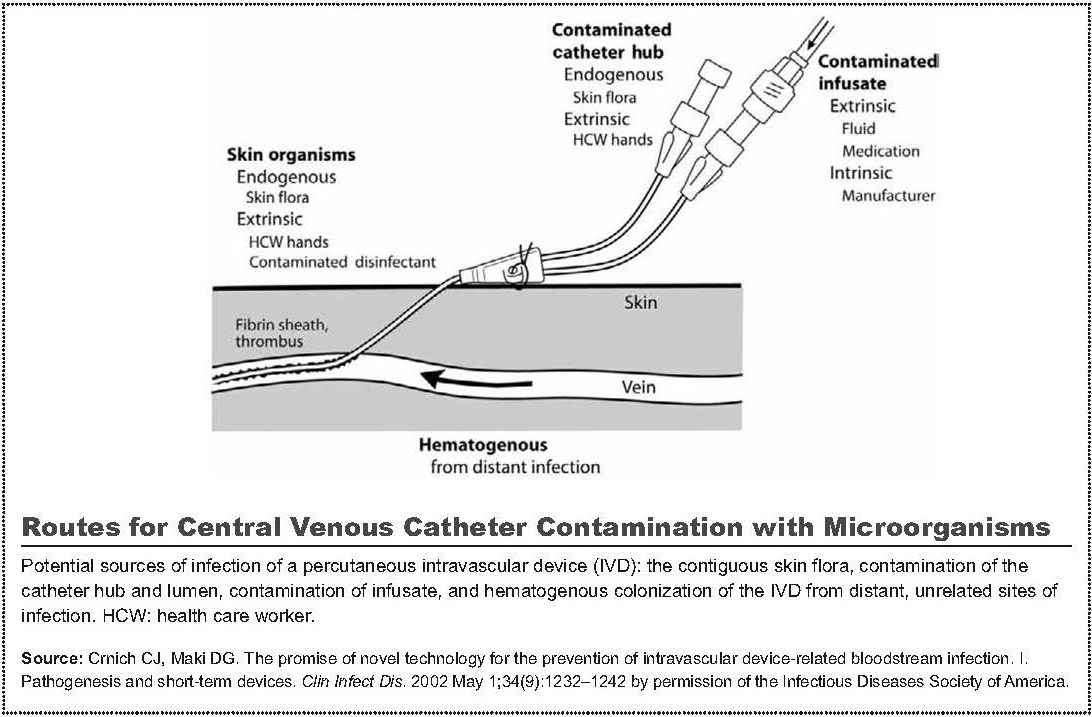 Clabsi Fishbone Infectious Disease Epidemiology & Prevention Division: Central Line ...