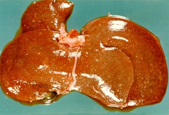 Presence of Tularemia in an infected Rabbit rabbit liver