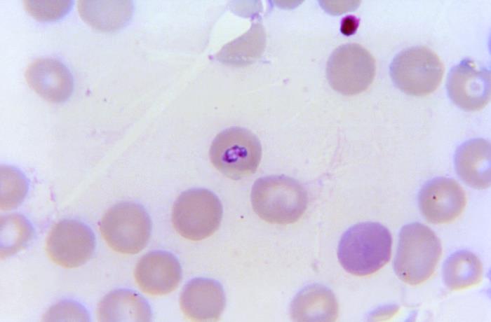 Babesia microti inside a red blood cell. Photo: Centers for Disease Control and Prevention.