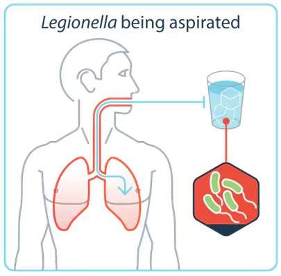 Transmission - Aspiration